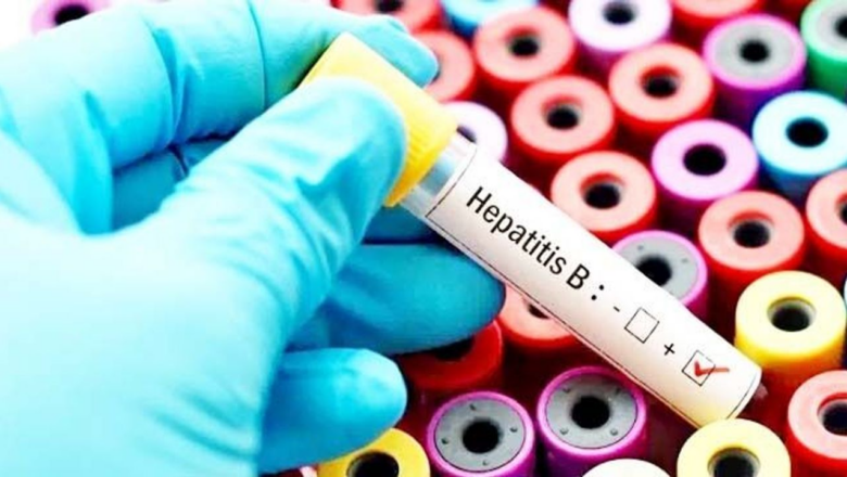 Hepatit B